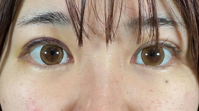 手术前的状态 其一