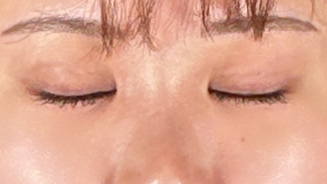 手术前的状态 其一