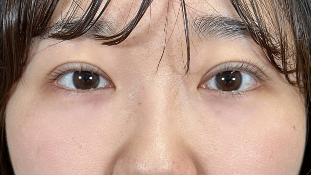 Postoperative Condition Part 1