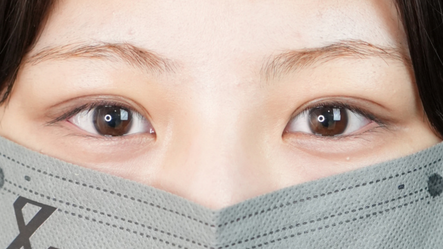 手術前の状態 その1