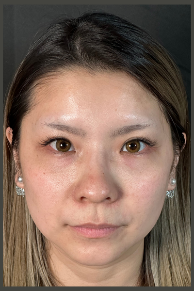 手术前的状态 其一