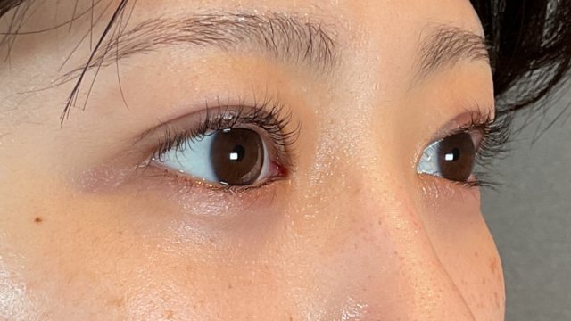 手术前的状态 其一