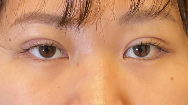 Postoperative Condition Part 1