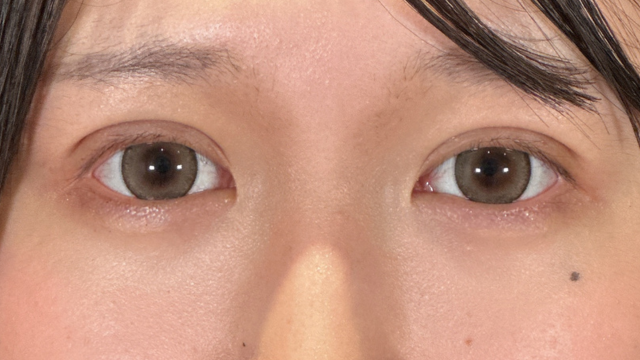 手术前的状态 其一