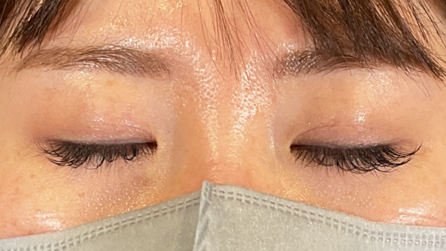 手术前的状态 其一