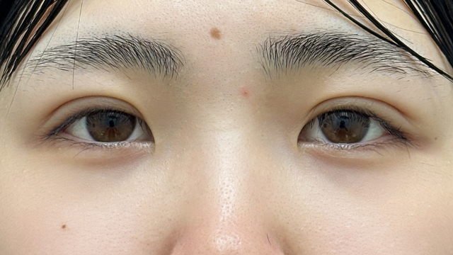 Postoperative Condition Part 1