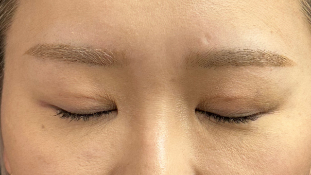 手术前的状态 其一