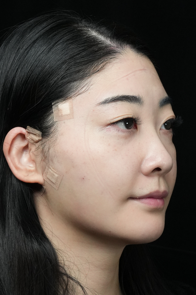 Postoperative Condition Part 1