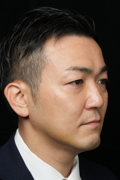 手術前の状態 その1