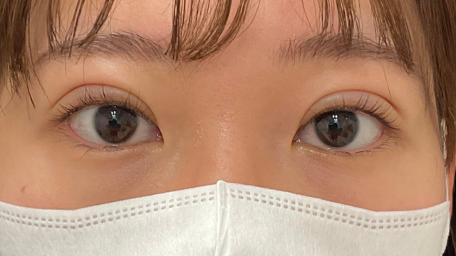 手术前的状态 其一