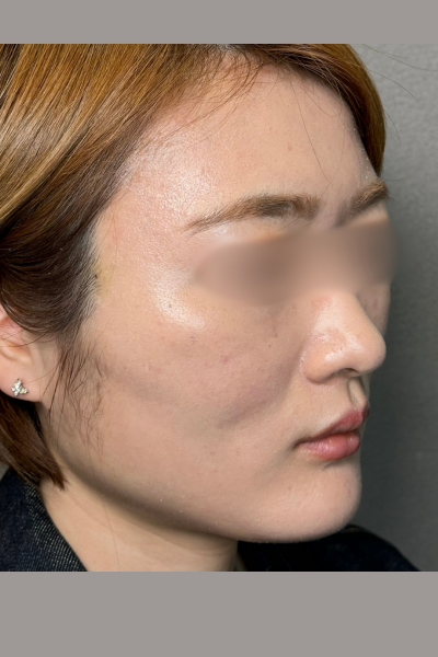 手術前の状態 その1