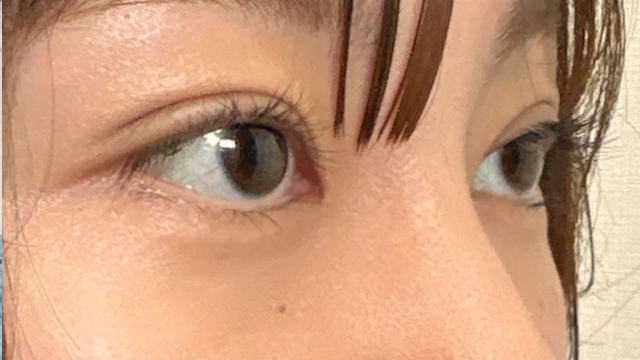 手术前的状态 其一