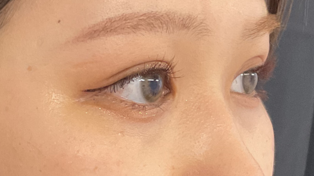 手术前的状态 其一