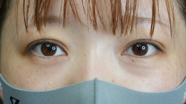 手术前的状态 其一