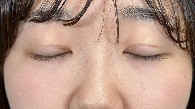 Postoperative Condition Part 1