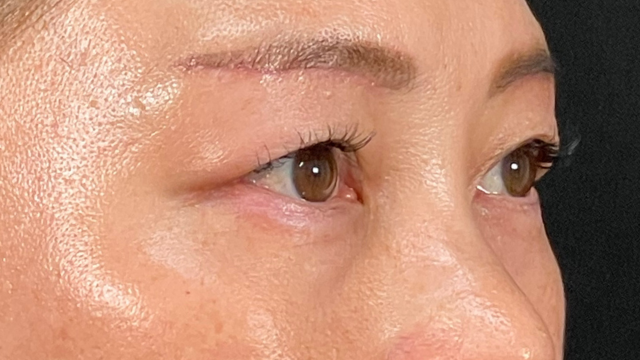 Postoperative Condition Part 1