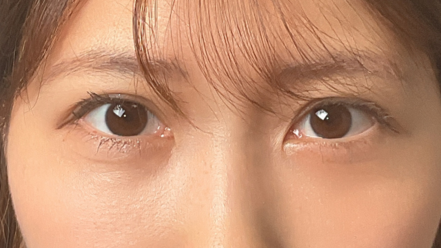 Postoperative Condition Part 1