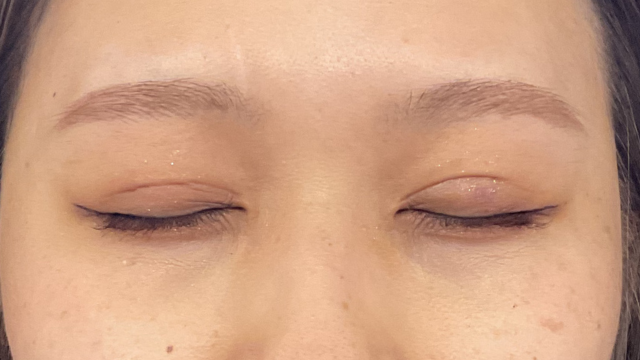 手术前的状态 其一