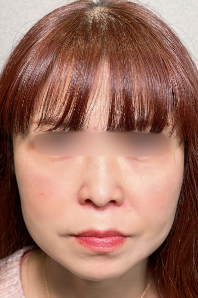 Postoperative Condition Part 1