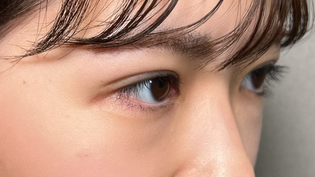 手术前的状态 其一