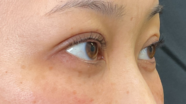 手术前的状态 其一