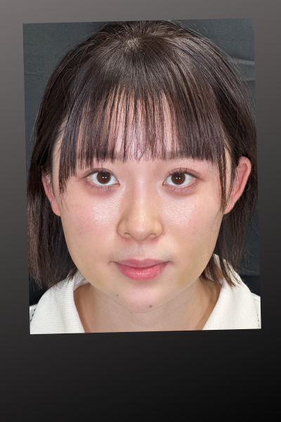 手術前の状態 その1