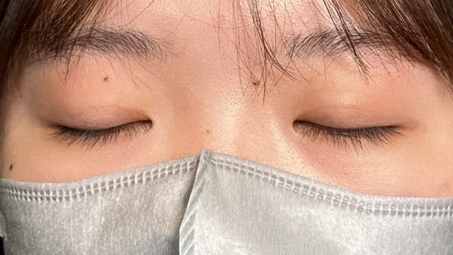 手术前的状态 其一