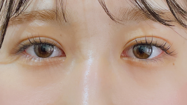 手术前的状态 其一