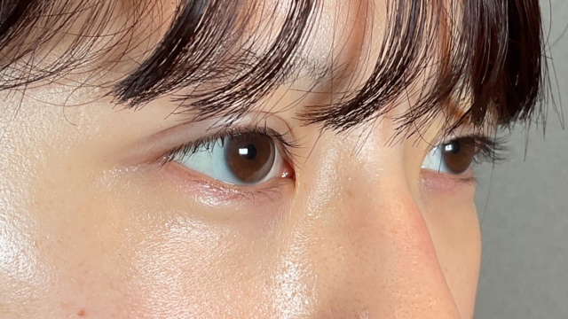 手术前的状态 其一