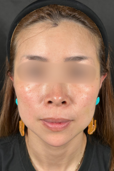 手术前的状态 其一