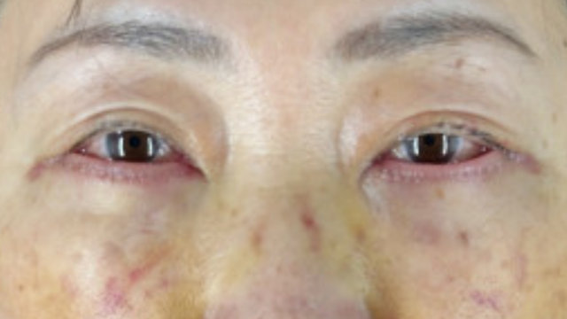 Postoperative Condition Part 1