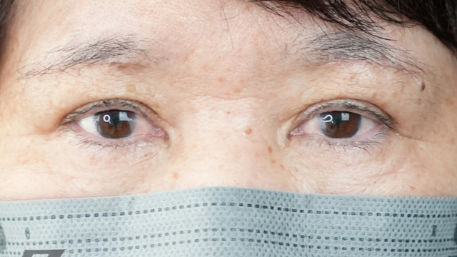 手术前的状态 其一