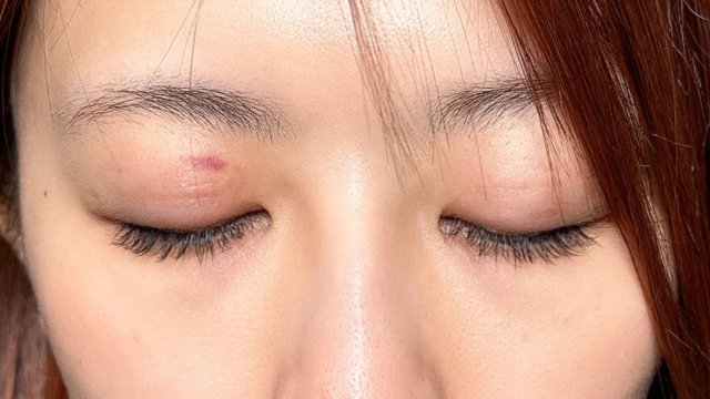 手术前的状态 其一