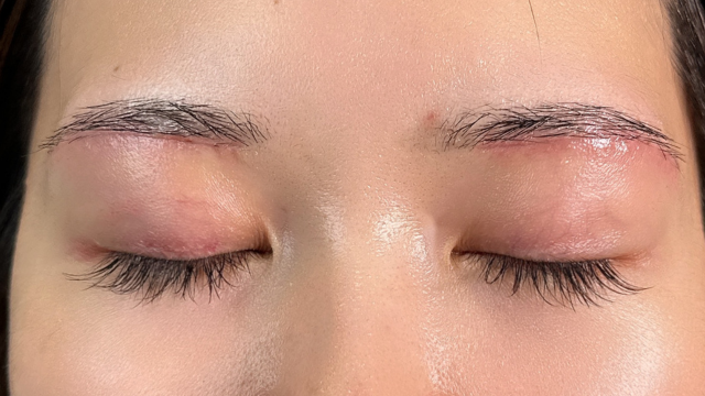 Postoperative Condition Part 1