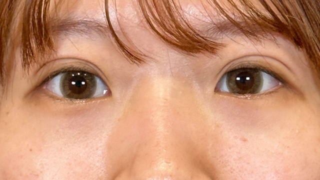 手术前的状态 其一