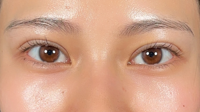 手术前的状态 其一