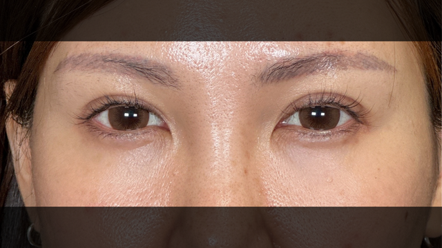 Postoperative Condition Part 1