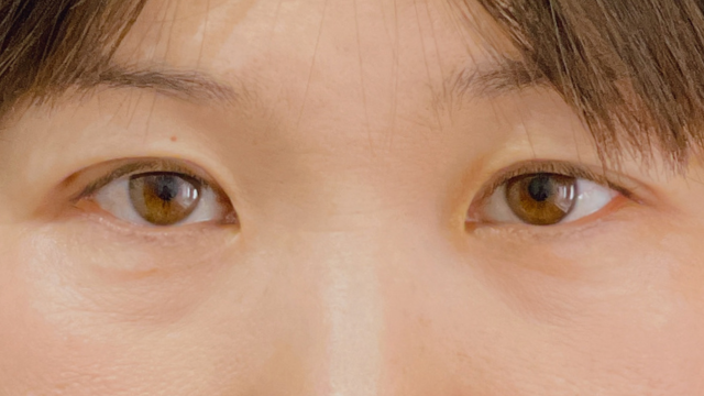 手术前的状态 其一