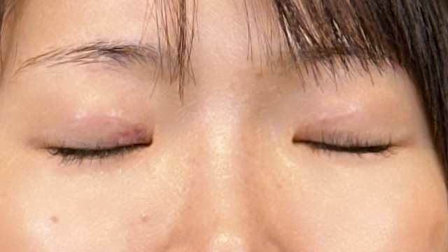 手术前的状态 其一