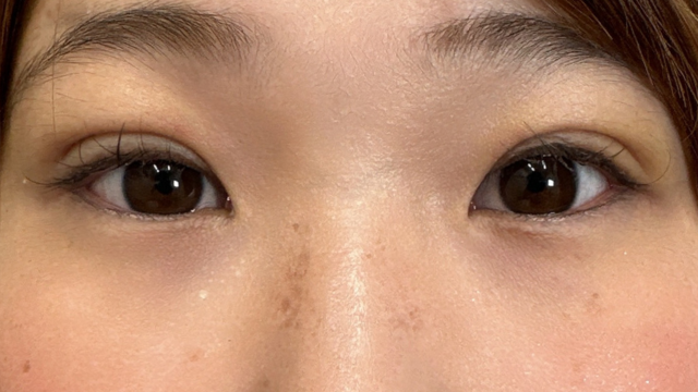 Postoperative Condition Part 1