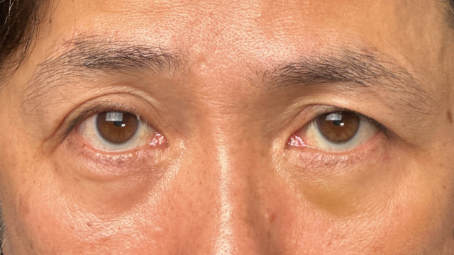 手术前的状态 其一