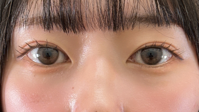 手術前の状態 その1