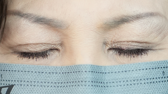 手术前的状态 其一