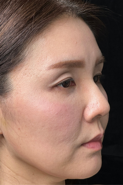 手術前の状態 その1