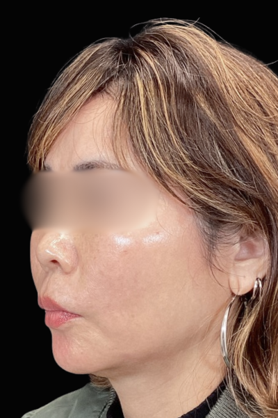 手術前の状態 その1