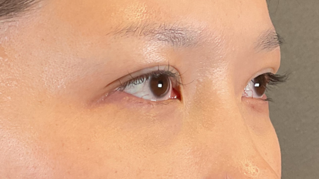 Postoperative Condition Part 1