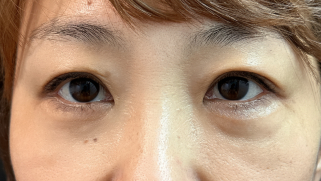 Postoperative Condition Part 1