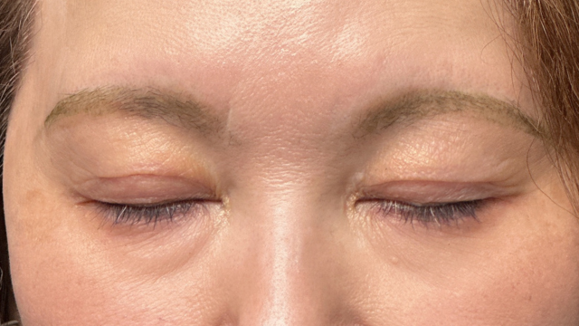 手术前的状态 其一