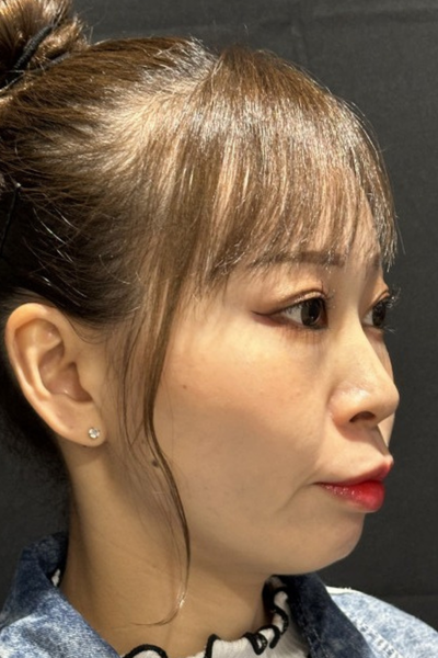 手术前的状态 其一