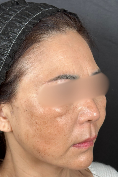 手術前の状態 その1